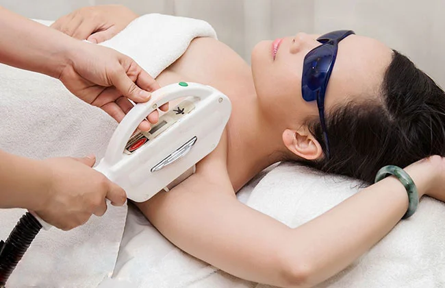 Triệt lông bằng laser là một phương pháp tiên tiến và hiệu quả