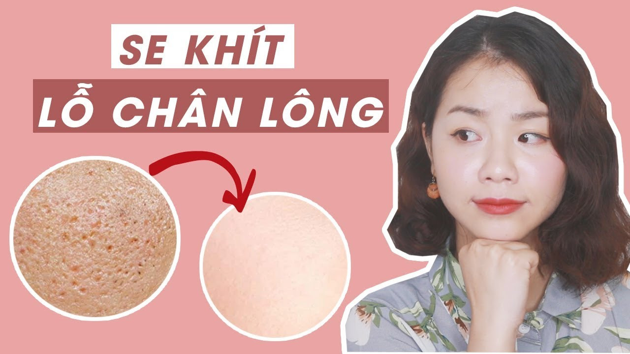 Mách bạn 7 Cách làm se khít lỗ chân lông tại nhà hiệu quả và an toàn trong 1 tuần