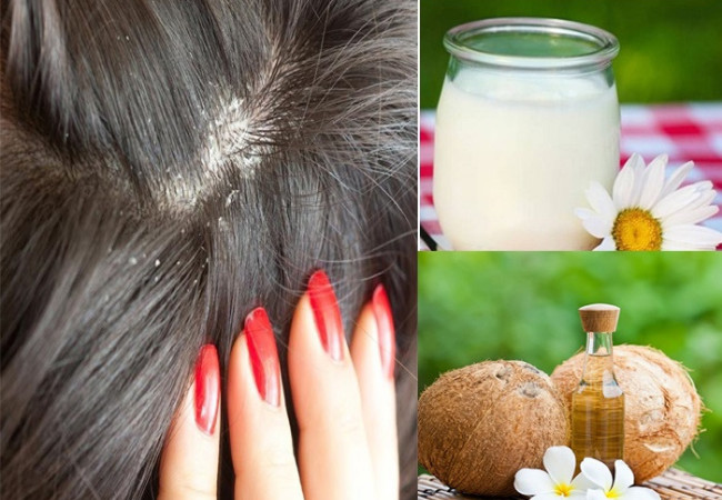 Giật mình với 20 tác dụng của dầu dừa mà chưa chắc ai cũng biết
