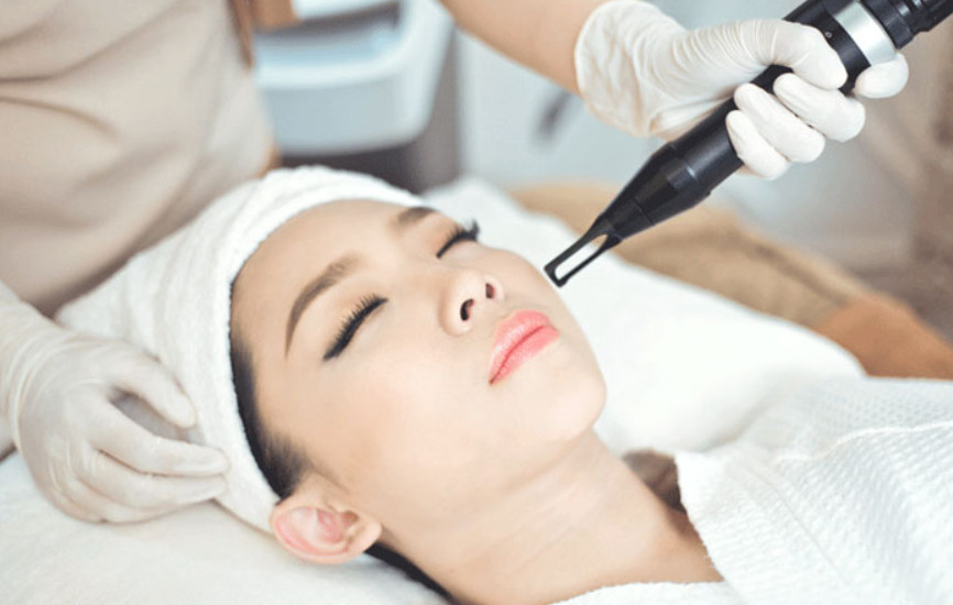 Cách trị nám bằng công nghệ laser