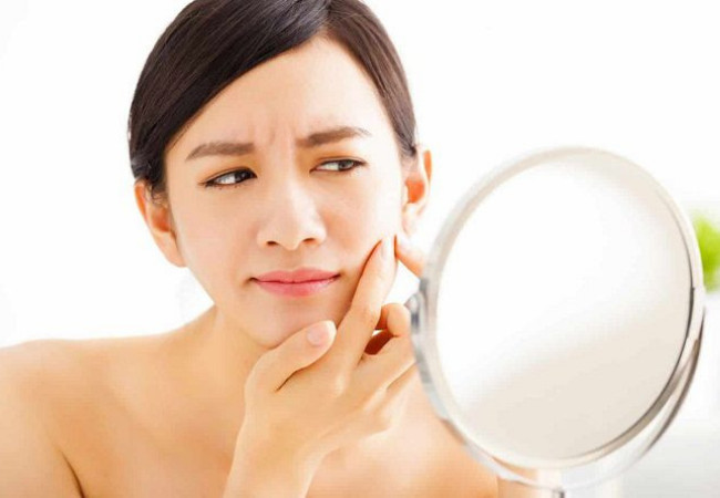 Nặn mụn có nên hay không?